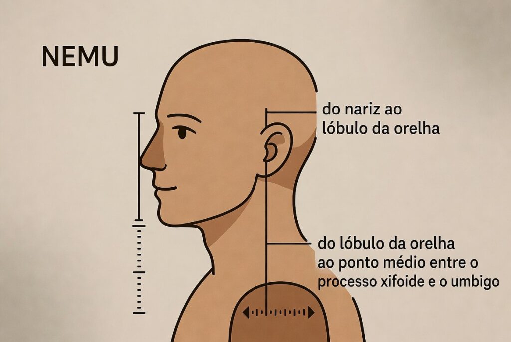 Ilustração demonstrando o método NEMU para medir uma sonda de alimentação nasoenteral.