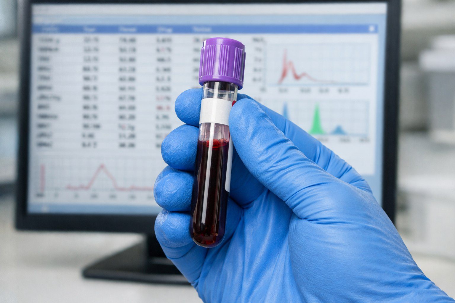 Enfermeiro analisando tubos de coleta para interpretação de exames laboratoriais.